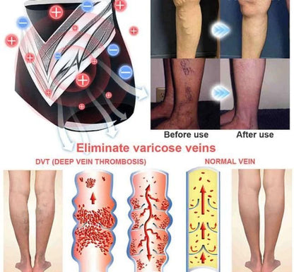 Titanium Fibre Tourmaline Shaping Shorts